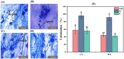 Piriformospora indica alleviates soda saline-alkaline stress in Glycine max by modulating plant metabolism